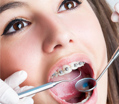 braces wear dental brace dentist affordable dentistry orthodontics place extractions tooth